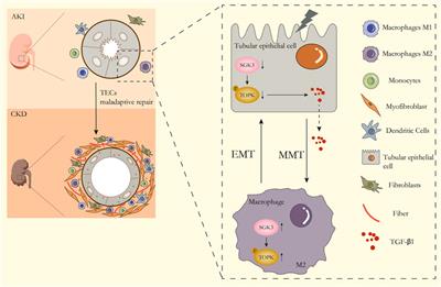 The role of the SGK3/TOPK signaling pathway in the transition from acute kidney injury to chronic kidney disease